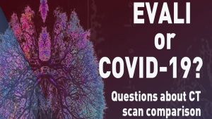 Some 2019 EVALI patients in the US may have been infected with COVID-19: Sources