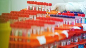 Omicron, nucleic acid test kit, chinese medical laboratory